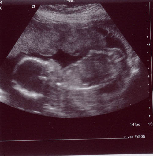Scan pic